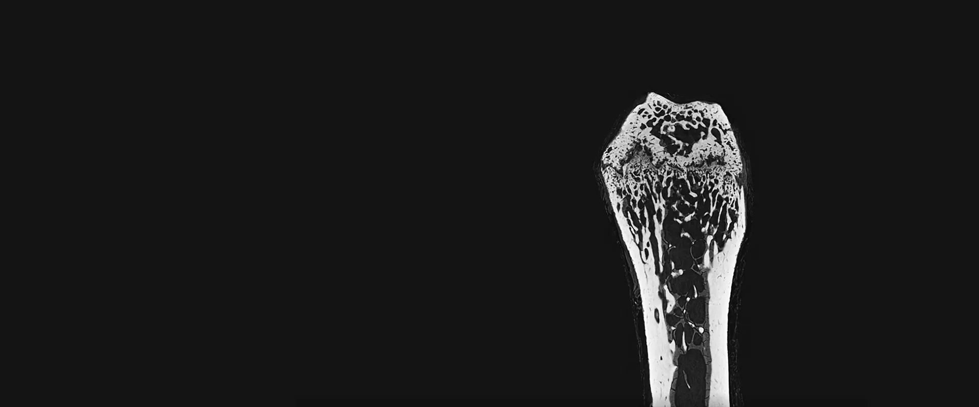 Micro-CT