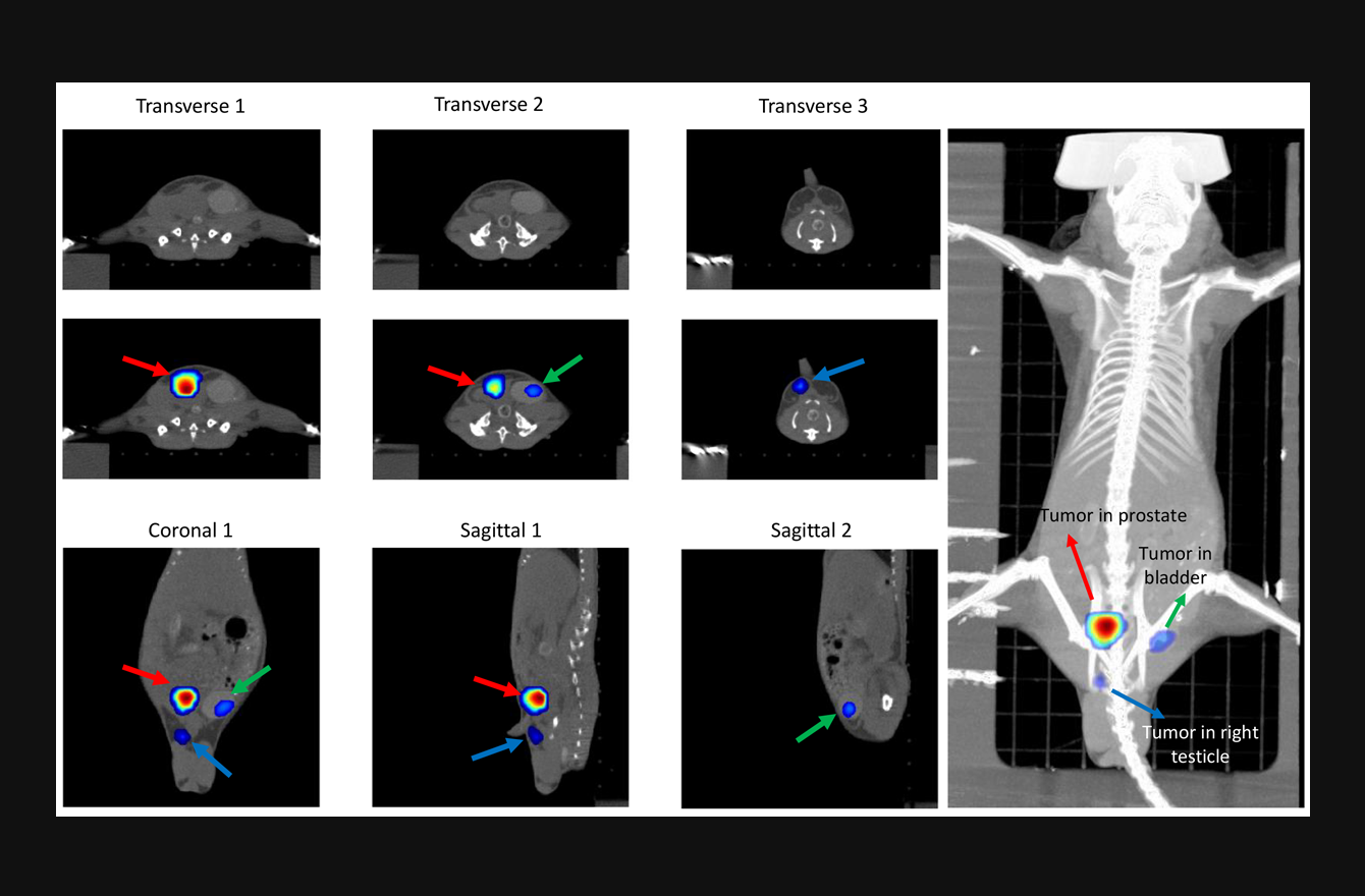 Bone Research