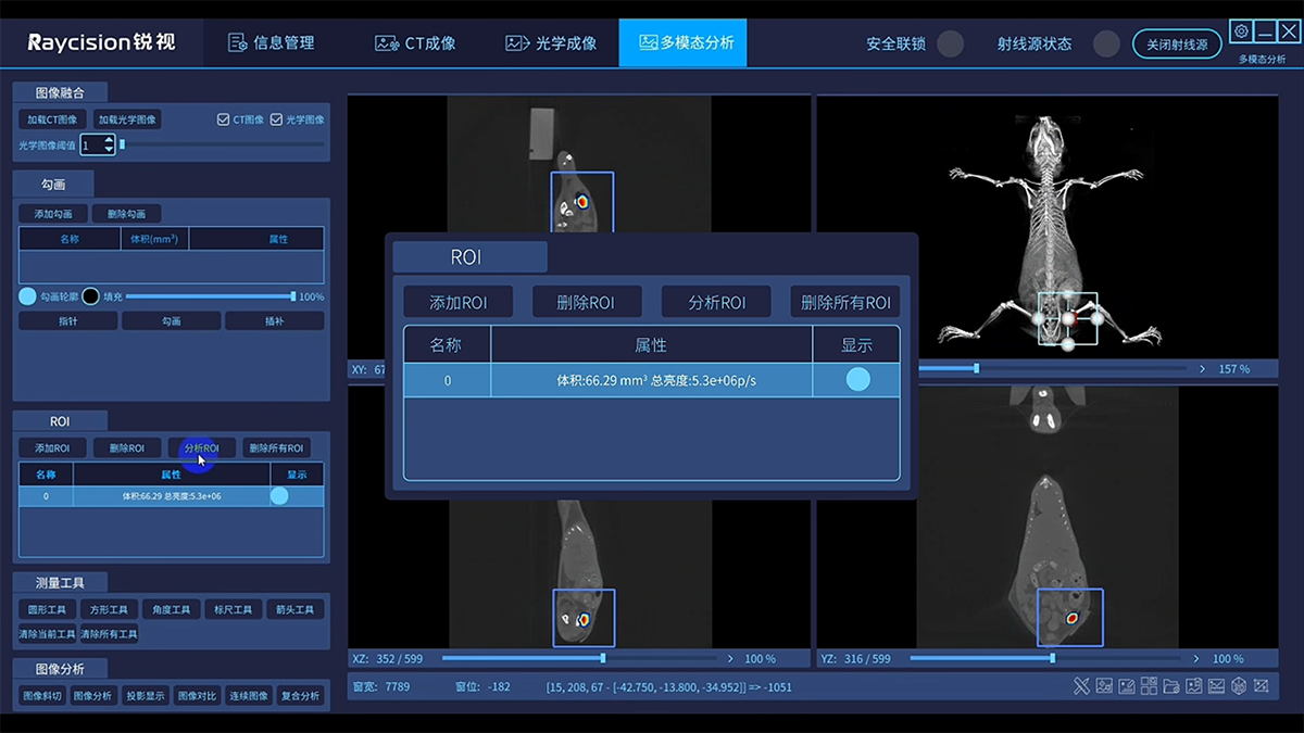 AI 赋能成像分析软件